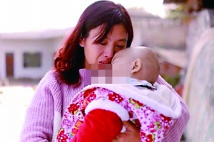 女童脸上长肿瘤北京好心人援助